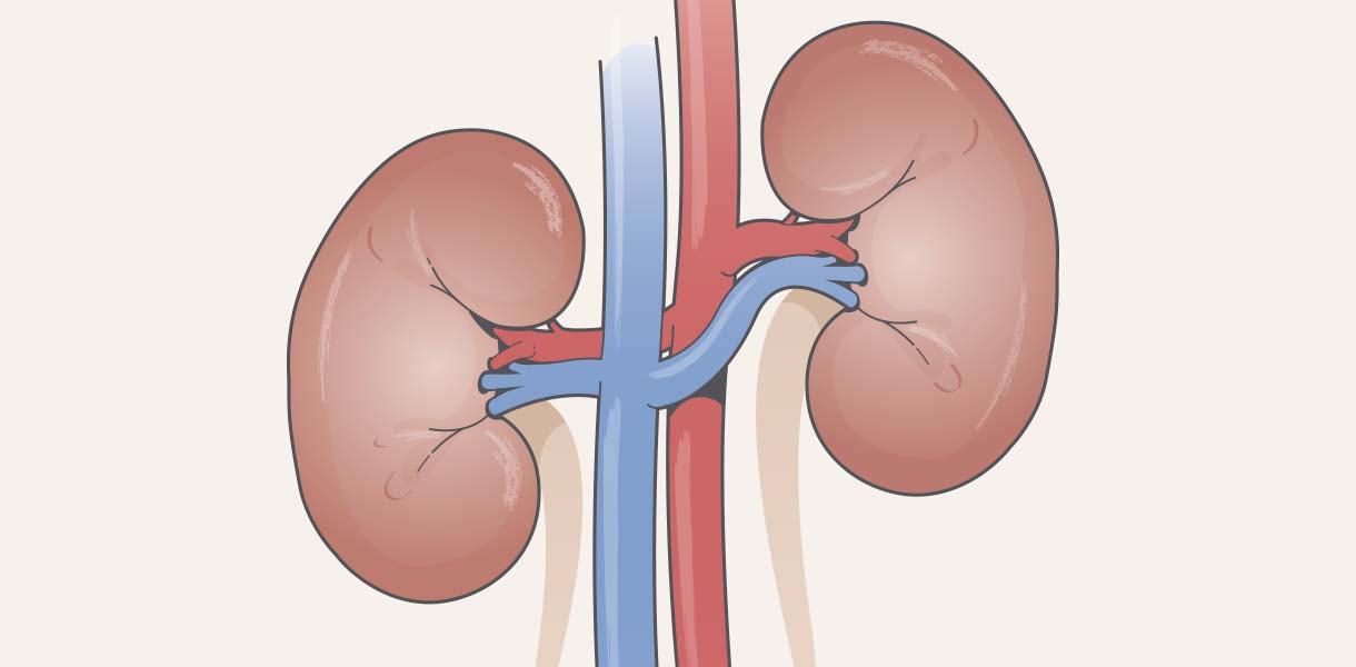 Doença renal crónica